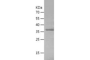 Western Blotting (WB) image for Sema Domain, Immunoglobulin Domain (Ig), Transmembrane Domain (TM) and Short Cytoplasmic Domain, (Semaphorin) 4D (SEMA4D) (AA 759-862) protein (His-IF2DI Tag) (ABIN7125019)