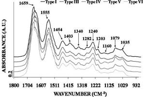 Fourier-transform infrared (FTIR) spectroscopy.
