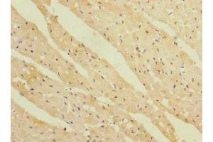Immunohistochemistry of paraffin-embedded human heart tissue using ABIN7167443 at dilution of 1:100 (REEP3 anticorps  (AA 80-255))
