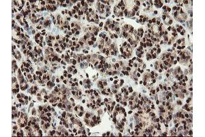 Image no. 7 for anti-SAM Domain and HD Domain 1 (SAMHD1) antibody (ABIN1500798)