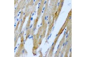 Immunohistochemical analysis of RRM2 staining in rat heart formalin fixed paraffin embedded tissue section.