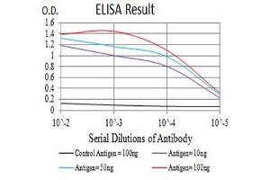 Black line: Control Antigen (100 ng),Purple line: Antigen (10 ng), Blue line: Antigen (50 ng), Red line:Antigen (100 ng)