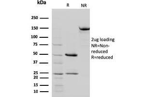 SDS-PAGE Analysis Purified STAT5B Mouse Monoclonal Antibody (STAT5B/2657). (STAT5B anticorps)