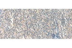 Immunohistochemistry of paraffin-embedded Human tonsil tissue using HASPIN Polyclonal Antibody at dilution of 1:45(x200)