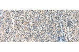 Immunohistochemistry of paraffin-embedded Human tonsil tissue using HASPIN Polyclonal Antibody at dilution of 1:45(x200) (GSG2 anticorps)