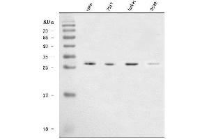Western blot analysis of SAP30 using anti-SAP30 antibody (ABIN7602922).