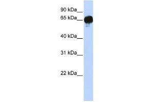 DGKE antibody used at 1 ug/ml to detect target protein. (DGKE anticorps  (N-Term))