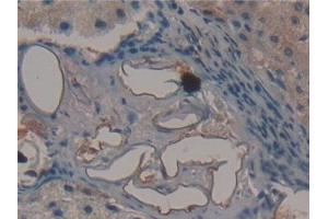 Detection of FMOD in Human Liver Tissue using Polyclonal Antibody to Fibromodulin (FMOD)