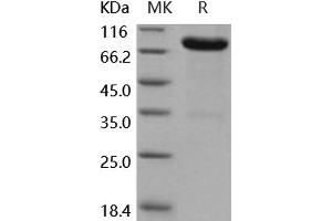 Western Blotting (WB) image for Interleukin 13 Receptor, alpha 2 (IL13RA2) (Active) protein (His tag,Fc Tag) (ABIN7196405)