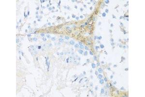 Immunohistochemistry of paraffin-embedded Mouse leydig cells using NRF2 Polyclonal Antibody at dilution of 1:100 (40x lens). (NRF2 anticorps)