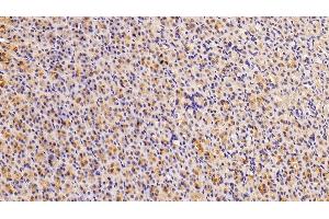 Detection of GAL4 in Rat Stomach Tissue using Polyclonal Antibody to Galectin 4 (GAL4)