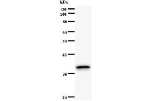 Western Blotting (WB) image for anti-PAP Associated Domain Containing 7 (PAPD7) antibody (ABIN931070) (PAP Associated Domain Containing 7 (PAPD7) anticorps)