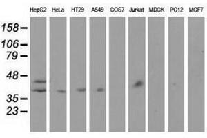 Image no. 2 for anti-Haptoglobin (HP) antibody (ABIN1498579) (Haptoglobin anticorps)