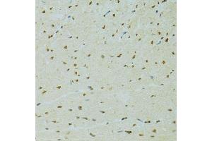 Immunohistochemistry of paraffin-embedded rat heart using RCC1 antibody. (RCC1 anticorps  (AA 1-240))