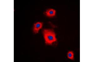 Immunofluorescent analysis of S6K1 (pS447) staining in A549 cells. (RPS6KB1 anticorps  (C-Term, pSer447))
