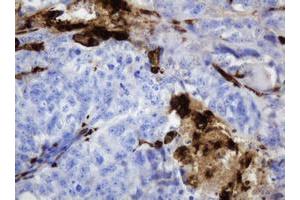 Image no. 9 for anti-Thymidine Phosphorylase (TYMP) (AA 311-482) antibody (ABIN1491396)