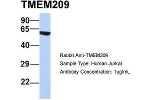 Host: Rabbit Target Name: TMEM209 Sample Type: Human Jurkat Antibody Dilution: 1. (TMEM209 anticorps  (N-Term))