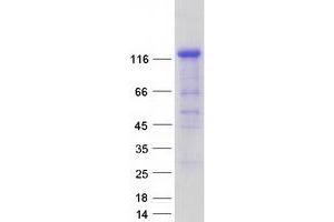 Validation with Western Blot