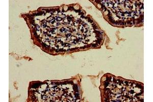 Immunohistochemistry of paraffin-embedded human small intestine tissue using ABIN7175320 at dilution of 1:100