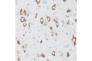 Immunohistochemistry of paraffin-embedded Rat brain using RPS18 antibody (ABIN6128660, ABIN6147205, ABIN6147206 and ABIN6215379) at dilution of 1:100 (40x lens).