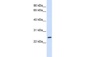 WB Suggested Anti-BAD Antibody Titration: 0.