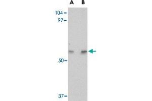 Western blot analysis of LGI4 in human brain tissue lysate with LGI4 polyclonal antibody  at (A) 1 and (B) 2 ug/mL . (LGI4 anticorps  (Internal Region))