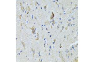 Immunohistochemistry of paraffin-embedded rat spinal cord using SARS Antibody.