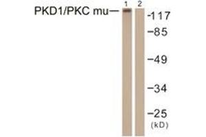 Western blot analysis of extracts from HepG2 cells, using PKD1/PKC mu (Ab-463) Antibody. (PKC mu anticorps  (AA 429-478))