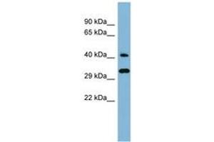 Image no. 1 for anti-DnaJ (Hsp40) Homolog, Subfamily C, Member 27 (DNAJC27) (AA 143-192) antibody (ABIN6741773)