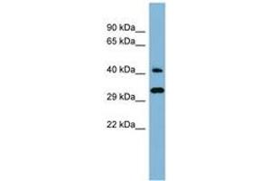 Image no. 1 for anti-DnaJ (Hsp40) Homolog, Subfamily C, Member 27 (DNAJC27) (AA 143-192) antibody (ABIN6741773) (DNAJC27 anticorps  (AA 143-192))
