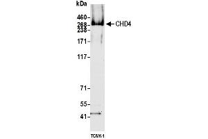 Western Blotting (WB) image for anti-Chromodomain Helicase DNA Binding Protein 4 (CHD4) antibody (ABIN7453323) (Recombinant CHD4 anticorps)