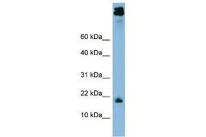 WB Suggested Anti-ASAH1 Antibody Titration: 0. (ASAH1 anticorps  (Middle Region))