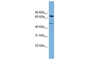WB Suggested Anti-STIM1  Antibody Titration: 0. (STIM1 anticorps  (Middle Region))