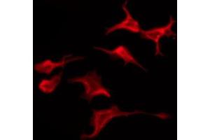 ABIN6274620 staining Hela by IF/ICC. (CMKLR1 anticorps  (Internal Region))
