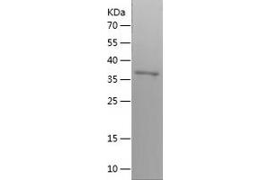 Western Blotting (WB) image for Major Vault Protein (MVP) (AA 130-443) protein (His tag) (ABIN7123832)