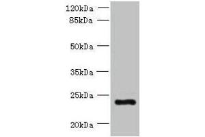 Western blot All lanes: PQLC3 antibody at 3 μg/mL + Mouse liver tissue Secondary Goat polyclonal to rabbit IgG at 1/10000 dilution Predicted band size: 23, 21 kDa Observed band size: 23 kDa (PQLC3 anticorps  (AA 118-170))