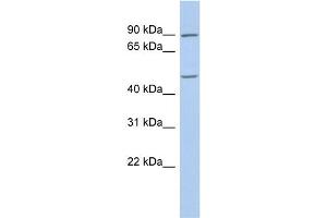WB Suggested Anti-PLAG1 Antibody Titration:  0. (PLAG1 anticorps  (C-Term))