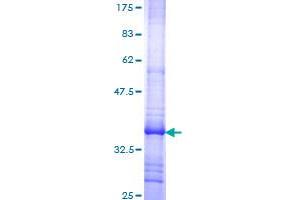 Image no. 1 for Solute Carrier Organic Anion Transporter Family, Member 1B1 (SLCO1B1) (AA 481-570) protein (GST tag) (ABIN1320553)