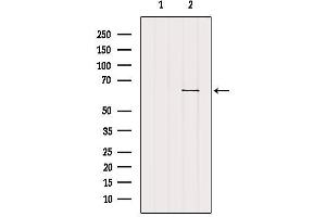 Western blot analysis of extracts from B16F10, using SLC22A6 Antibody. (SLC22A6 anticorps  (C-Term))