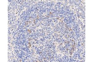 Immunohistochemistry analysis of paraffin-embedded rat spleen using CCR5 Polyclonal Antibody at dilution of 1:300. (CCR5 anticorps)