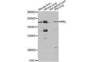 Western blot analysis of extracts of various cell lines, using PPL antibody. (PPL anticorps)