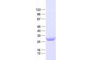 Validation with Western Blot