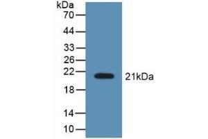 Detection of Recombinant LCN8, Mouse using Polyclonal Antibody to Lipocalin 8 (LCN8)