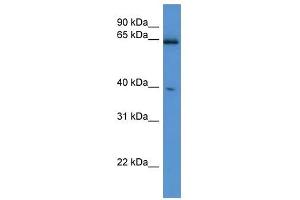Western Blot showing Asrgl1 antibody used at a concentration of 1-2 ug/ml to detect its target protein. (ASRGL1 anticorps  (C-Term))