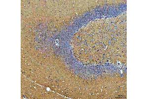 IHC analysis of Synapsin II using anti-Synapsin II antibody (ABIN4886735).