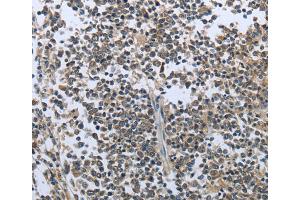 Immunohistochemistry (IHC) image for anti-Prolactin (PRL) antibody (ABIN2422068) (Prolactin anticorps)