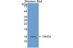 Western blot analysis of the recombinant protein. (AGGF1 anticorps  (AA 21-123))