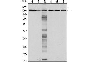 Western blot analysis using CDH1 mouse mAb against LNCAP (1),A431 (2), DU145 (3), PC-3 (4), PC-12 (5) and T47D(6) cell lysate. (E-cadherin anticorps)