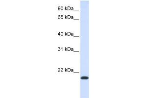 WB Suggested Anti-NKAIN1 Antibody Titration:  0. (NKAIN1 anticorps  (Middle Region))