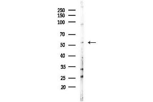 anti-Nuclear RNA Export Factor 3 (NXF3) (N-Term) antibody